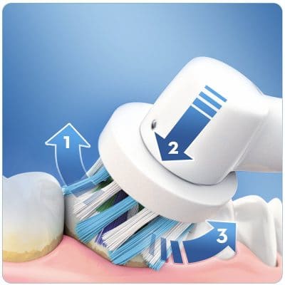 Fonctionnement brosse a dent electrique